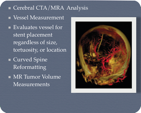 Neurology 3D Modeling