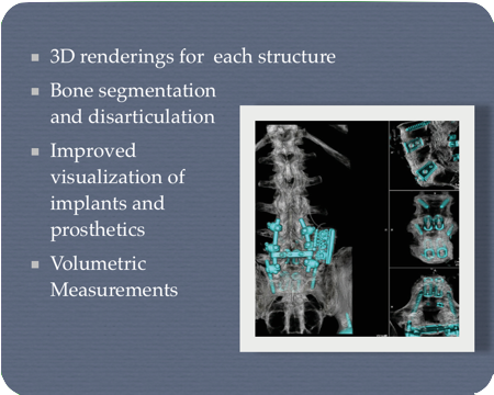 Orthopedics 3D Modeling