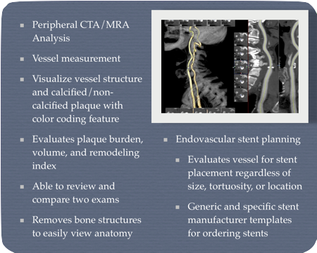 Vascular 3D Modeling